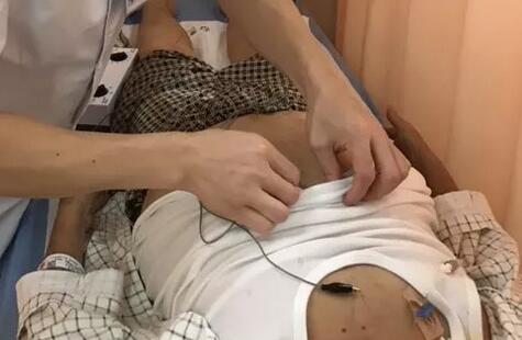 術後打嗝不止?快試試中醫針灸